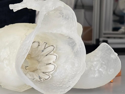 Grazie a cardiochirurghi e ingegneri, eccezionale intervento in 3D salva la vita ad un paziente alle Molinette