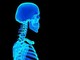Sindrome della 'testa che scivola sul collo', come riconoscerla e trattarla